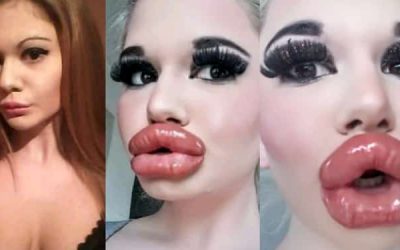 Ella es Andrea Ivanova la mujer con los labios mas grandes del mundo.