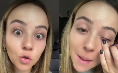 ¡No eran perrillas! Mujer descubre que tuvo un gusano en el ojo por 4 años